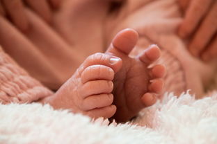 宝宝鸡胸怎么治保守还是手术？